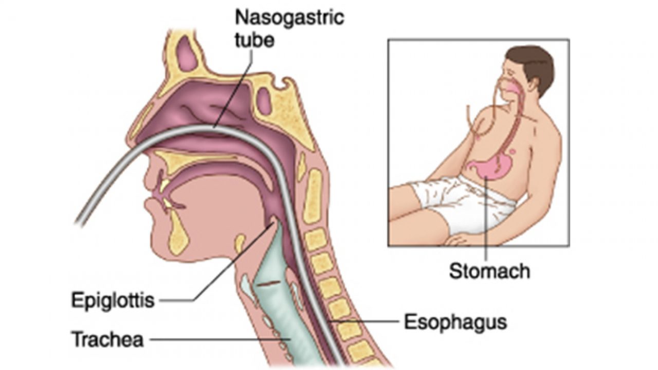 intubation anatomy